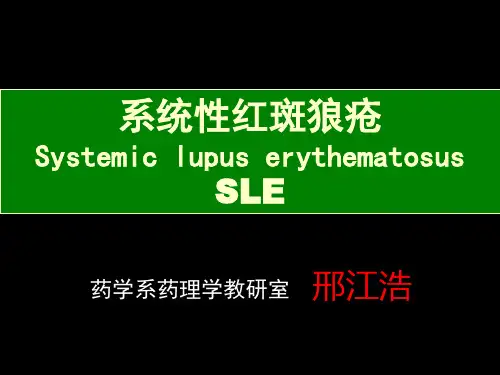 系统性红斑狼疮