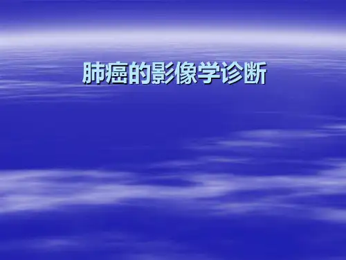 肺癌的影像学诊断 PPT课件