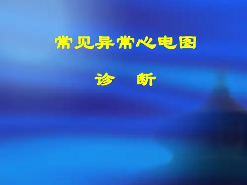 常见异常心电图诊断 ppt课件