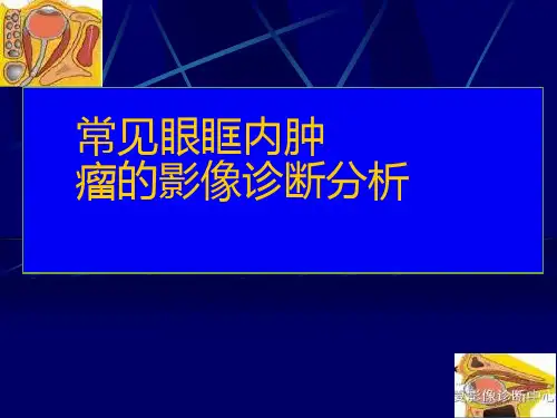 常见眼眶内肿瘤的影像诊断分析