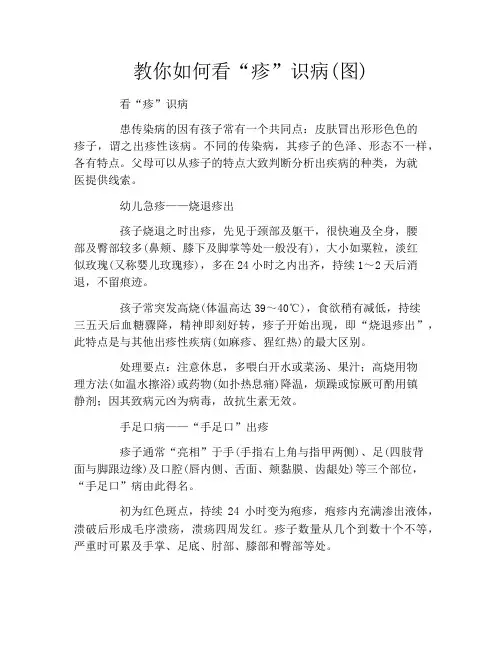 教你如何看“疹”识病(图)