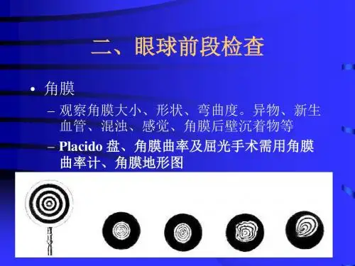 眼科检查法2