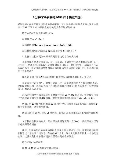 3分钟学会看腰椎MRI片