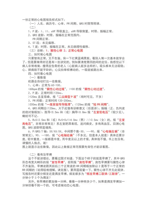 正常的心电图报告样式--简洁版