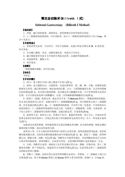 胃次全切除术(毕一式)