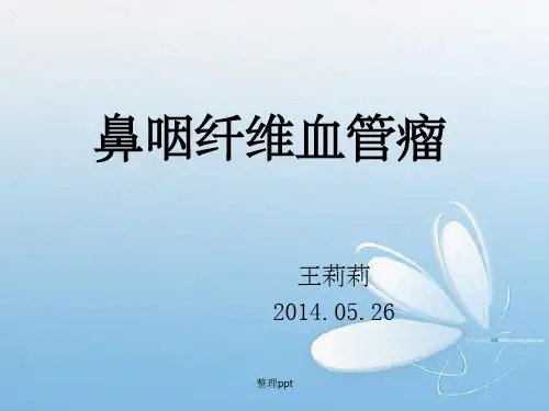 鼻咽部纤维血管瘤