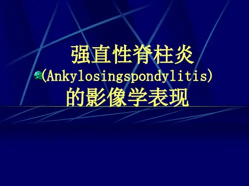 强直性脊柱炎的影像学表现