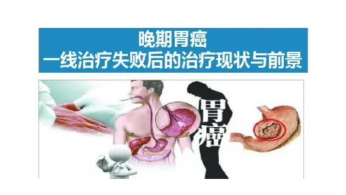 晚期胃癌治疗PPT课件.ppt