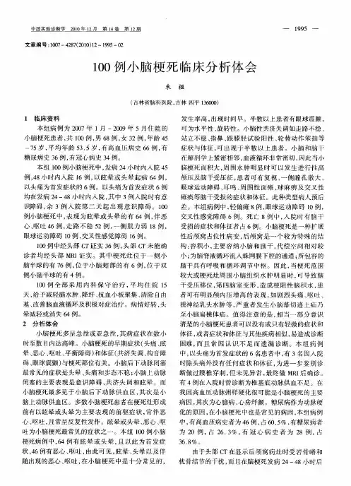 100例小脑梗死临床分析体会