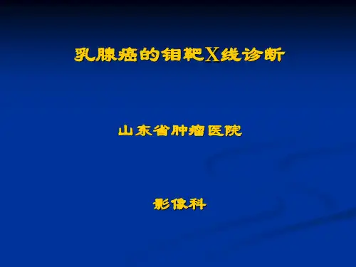 乳腺癌的X线诊断