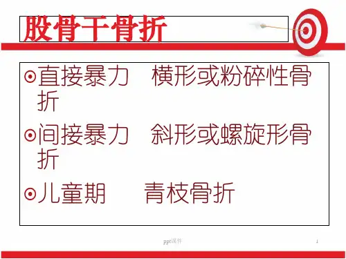 股骨干骨折  ppt课件