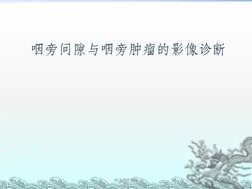 咽旁间隙及其周围间隙占位性病变的影像学ppt课件