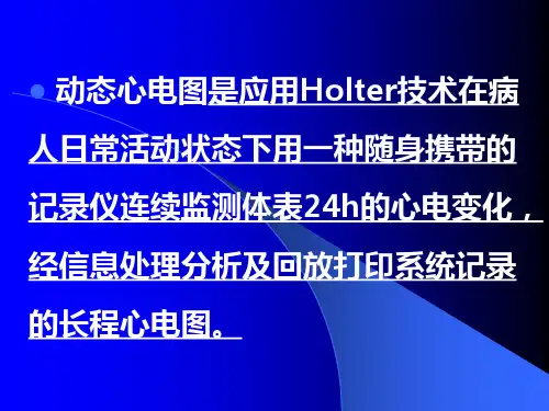 动态心电图(holter)