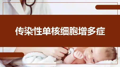 传染性单核细胞增多症-儿科学