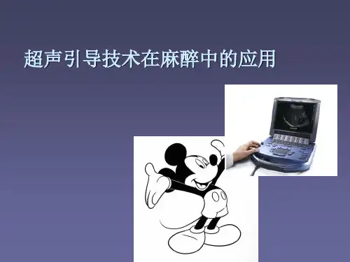 超声引导技术在麻醉科的应用ppt课件