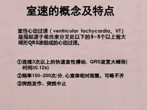 室速的诊断及鉴别诊断