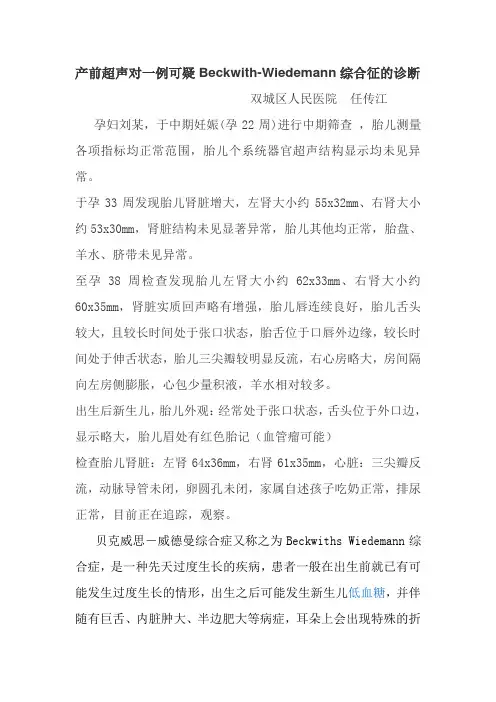 Beckwith-Wiedemann综合征