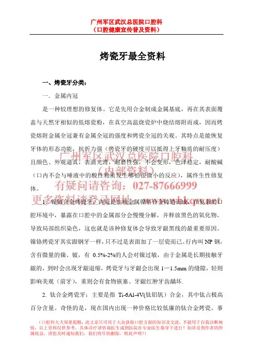 烤瓷牙最全资料