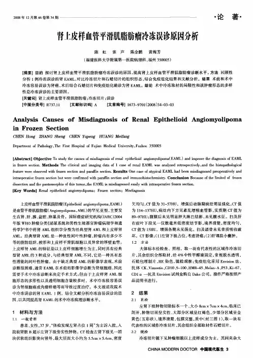 肾上皮样血管平滑肌脂肪瘤冷冻误诊原因分析