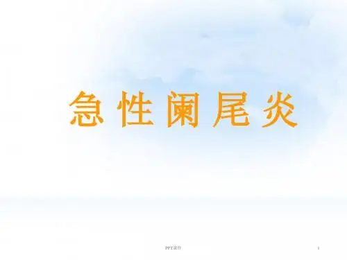 急性阑尾炎  ppt课件
