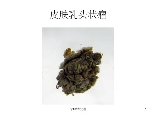 肿瘤病理图谱ppt课件