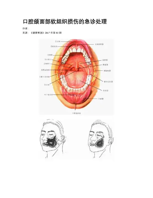 口腔颌面部软组织损伤的急诊处理