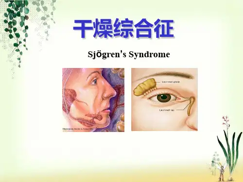干燥综合症护理ppt课件