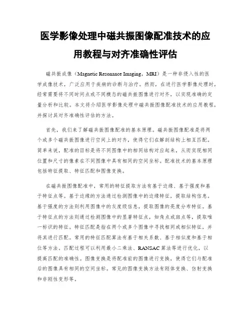医学影像处理中磁共振图像配准技术的应用教程与对齐准确性评估