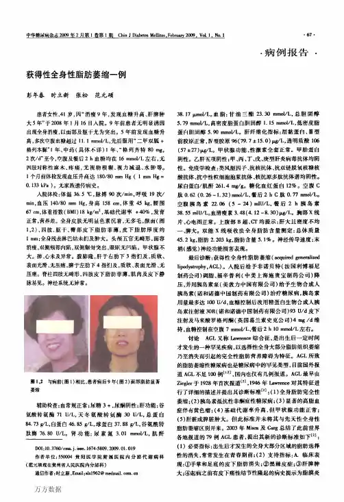 获得性全身性脂肪萎缩一例