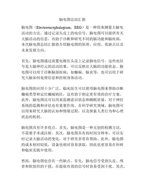 脑电图总结汇报