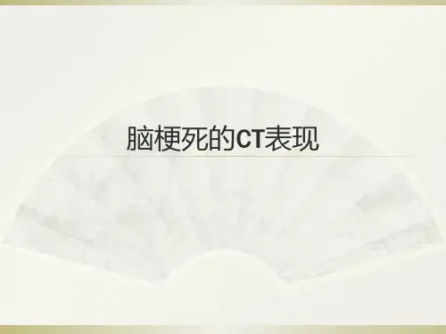 脑梗死的CT表现-PPT精品课件