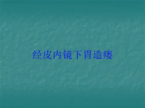 经皮内镜下胃造瘘培训课件