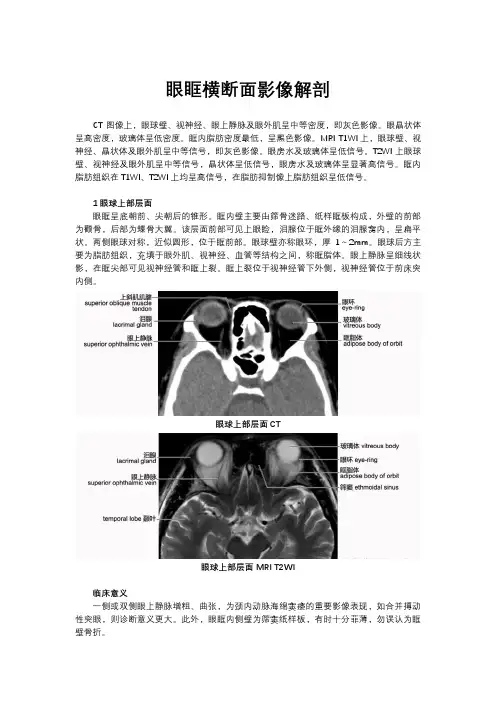眼眶横断面影像解剖