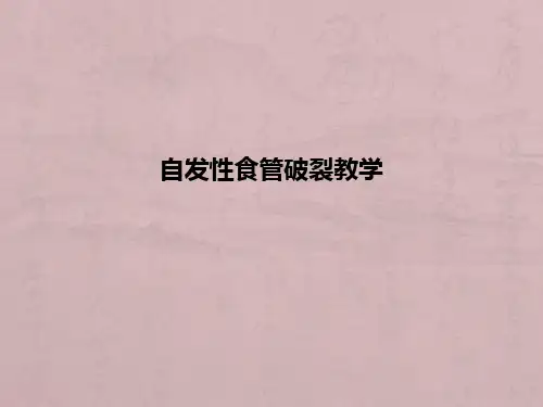自发性食管破裂ppt课件