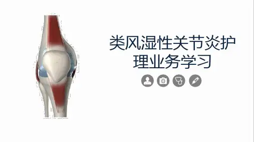 类风湿性关节炎护理PPT