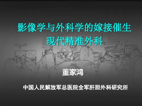 10.18精准肝切除-董家鸿