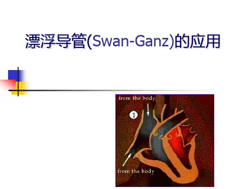 漂浮导管的应用