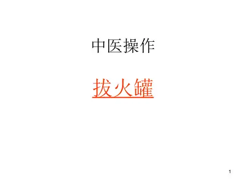 中医操作拔火罐ppt课件