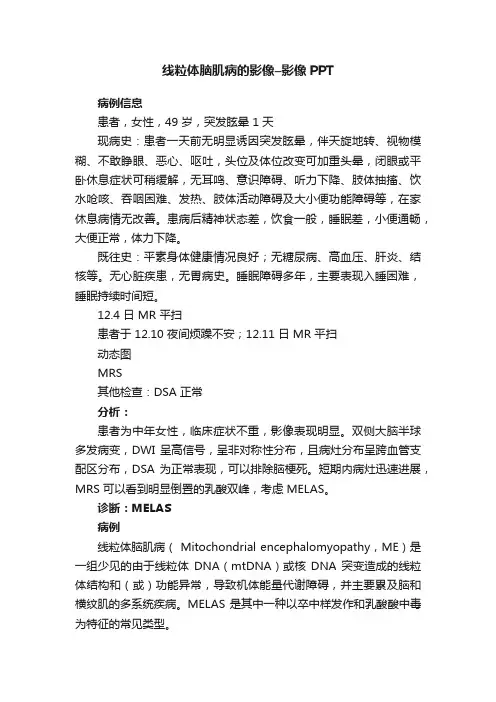 线粒体脑肌病的影像–影像PPT