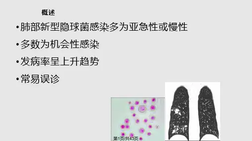 肺隐球菌病的诊断PPT课件