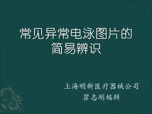 常见异常电泳图片的简易辨识