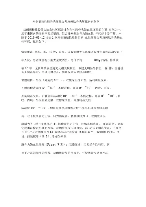 双侧酒精性股骨头坏死合并双侧肱骨头坏死病例分享
