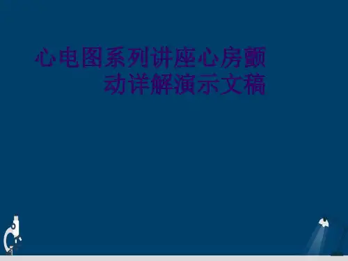 心电图系列讲座心房颤动详解演示文稿