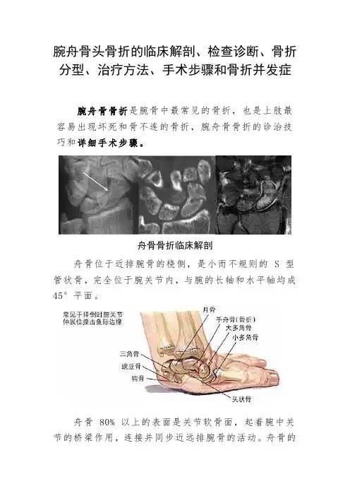 腕舟骨头骨折的临床解剖、检查诊断、骨折分型、治疗方法、手术步骤和骨折并发症