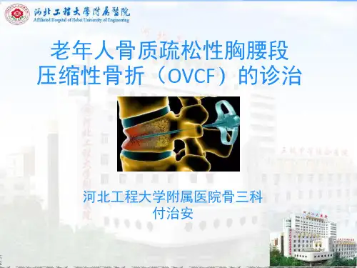 老年人骨质疏松性胸腰段压缩性骨折(OVCF)的诊治