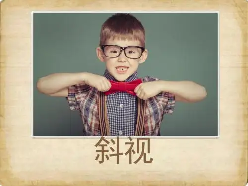《斜视》ppt课件