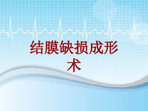 手术讲解模板：结膜缺损成形术