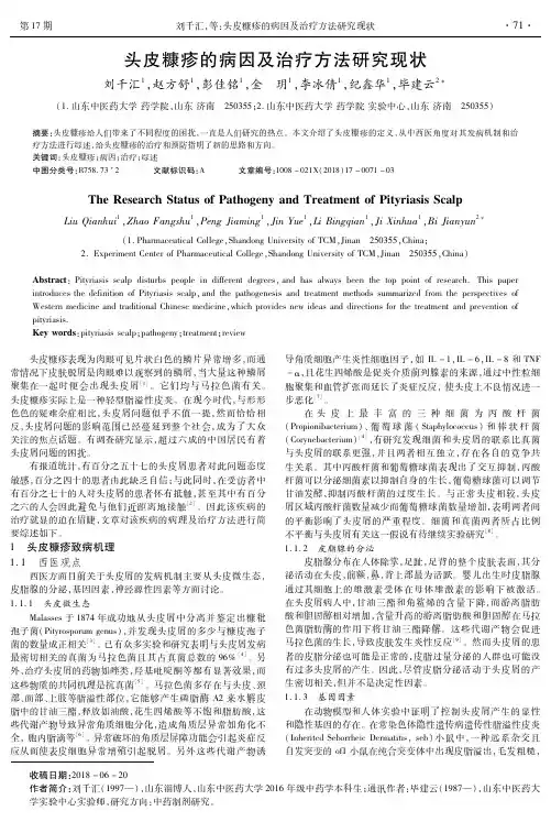 头皮糠疹的病因及治疗方法研究现状