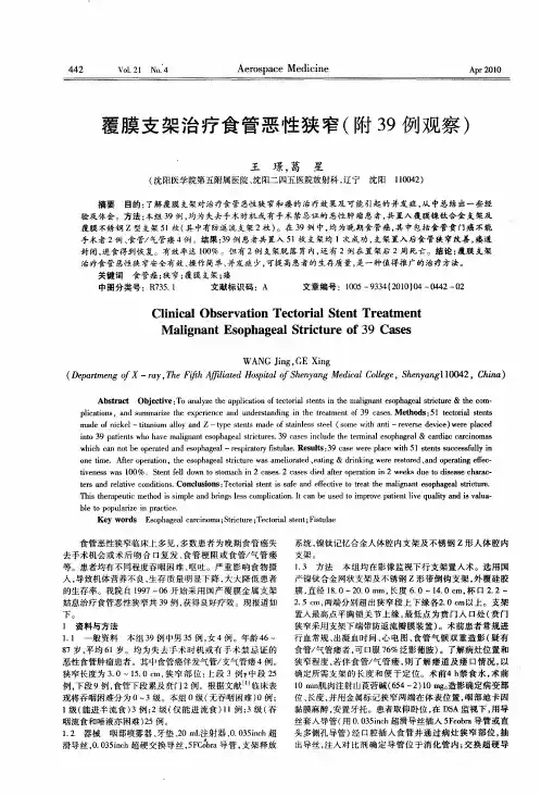 覆膜支架治疗食管恶性狭窄(附39例观察)