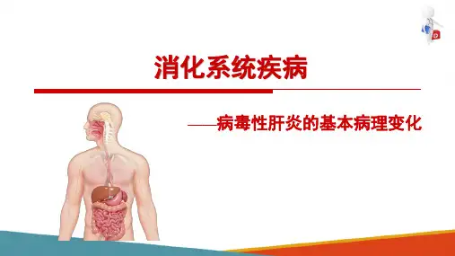病毒性肝炎—病毒性肝炎概述(病理学课件)